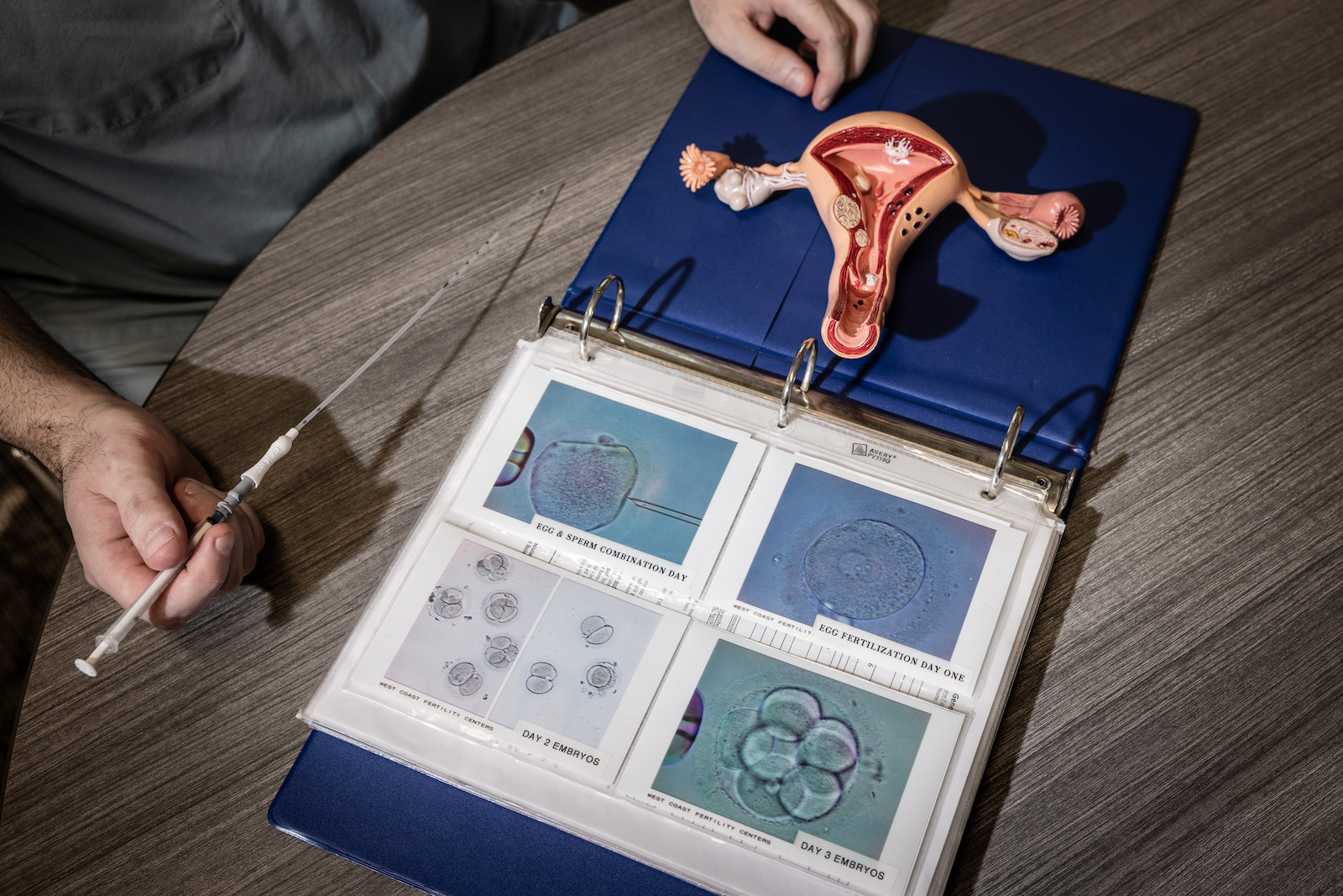 An embryo transfer catheter and a model of a uterus are displayed in a fertility clinic in California.